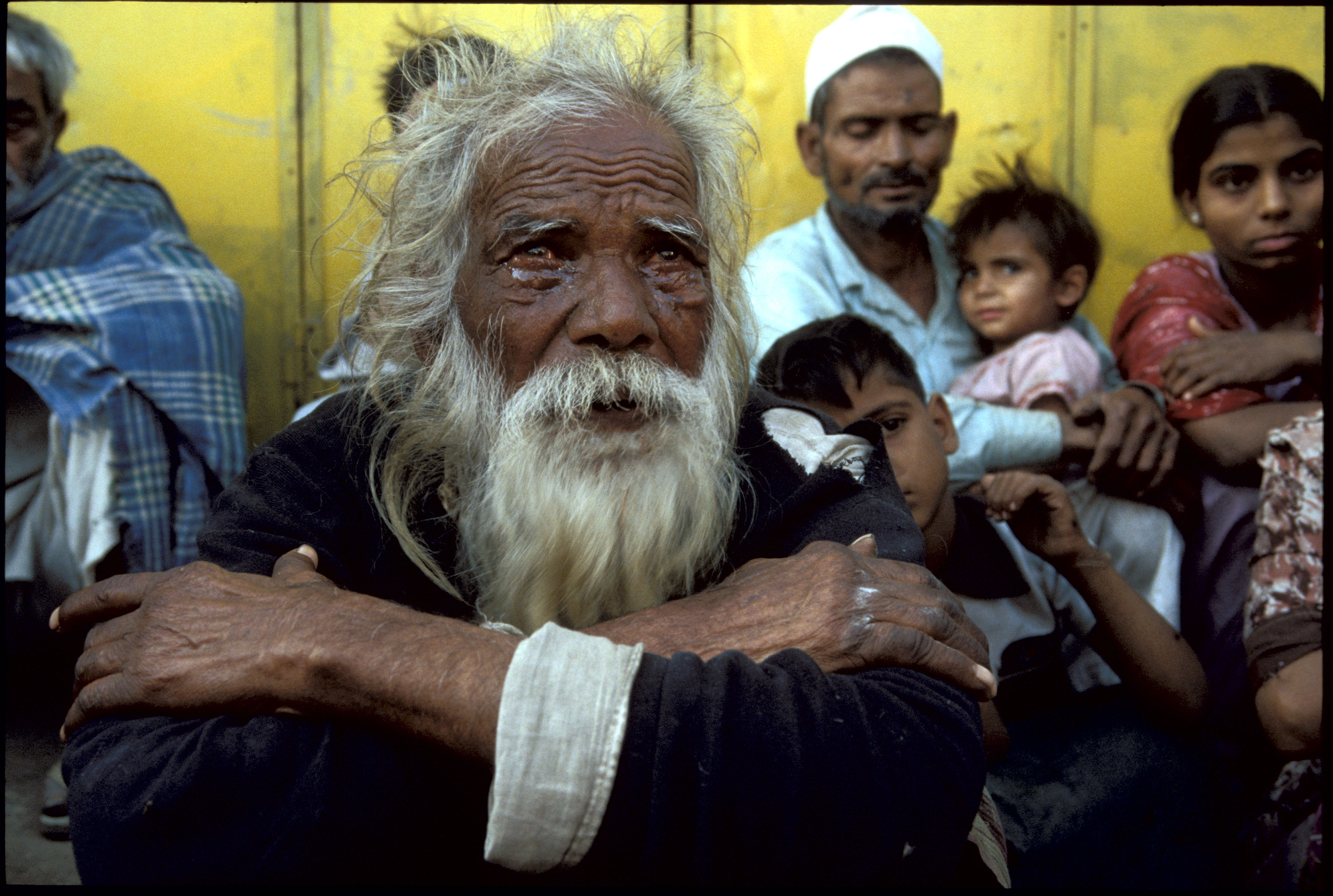 1984: Bhopal, India. Victims of Union Carbide industrial disaster. 1984: Bhopal, India. Victims of Union Carbide industrial disaster.