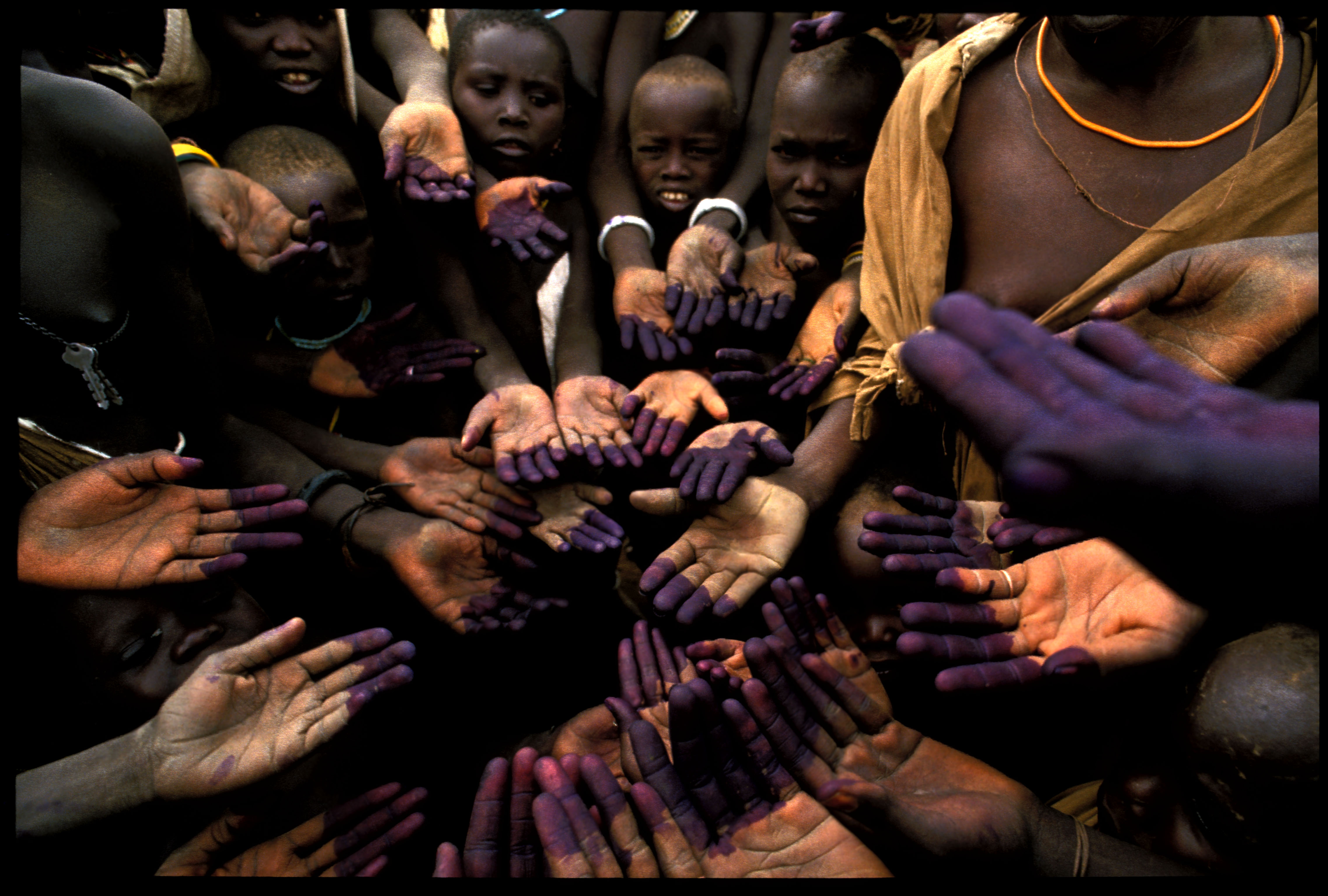 1986: Southern Sudan. Famine victims due to civil war. 1986: Southern Sudan. Famine victims due to civil war.